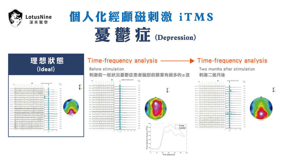 療程前後腦波時頻分析比較圖(衛教示意)
